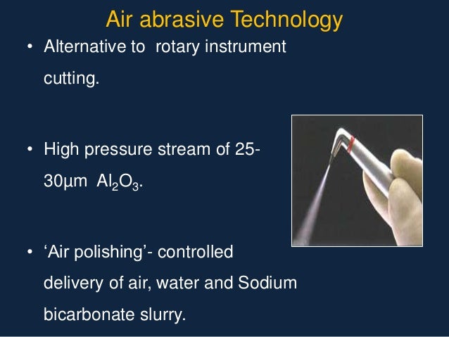 Abrasive agents in dentistry