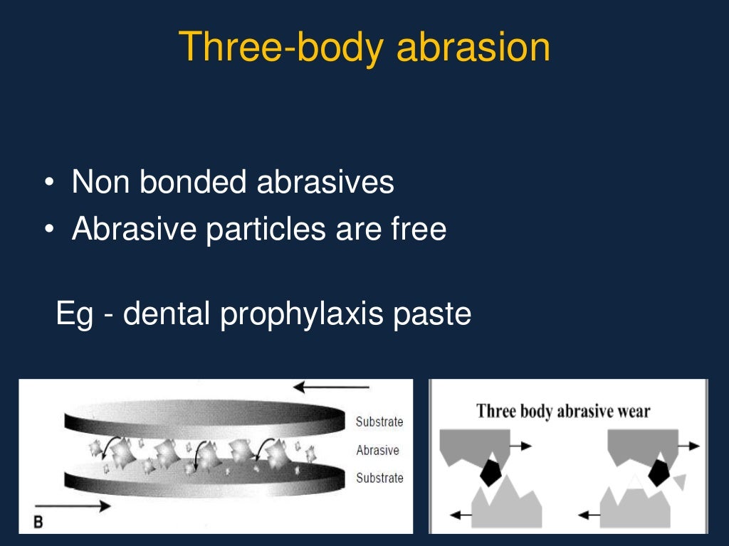 Abrasive agents in dentistry