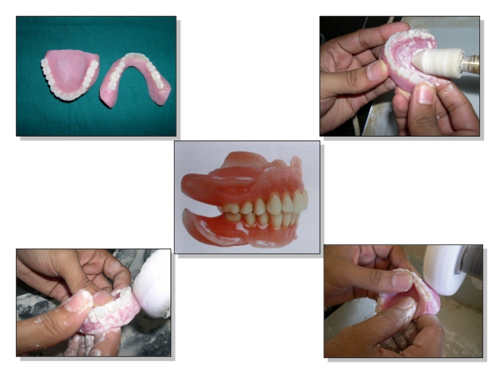 Abrasive and polishing agents in dentistry / dental courses