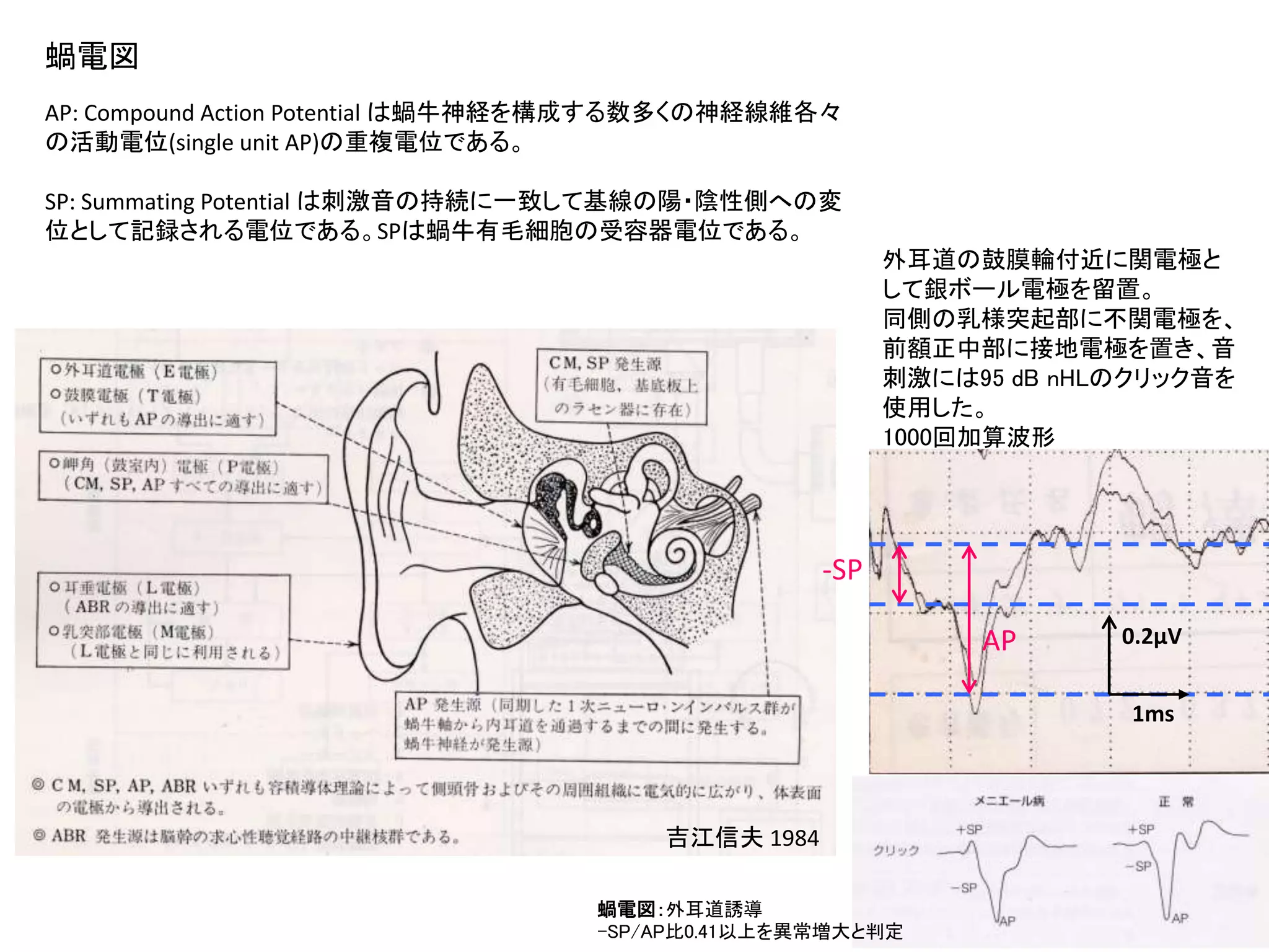 新人研修 ABR ASSR 2017 | PPTX