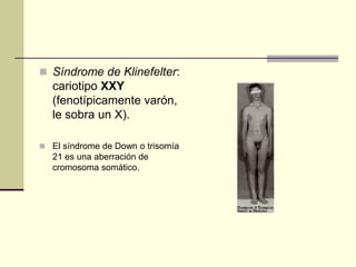  Síndrome de Klinefelter:
cariotipo XXY
(fenotípicamente varón,
le sobra un X).
 El síndrome de Down o trisomía
21 es una aberración de
cromosoma somático.
 