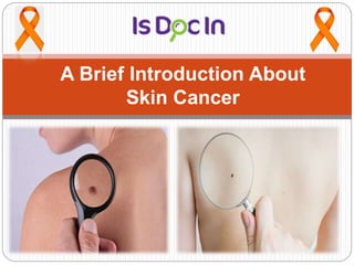 A Brief Introduction About
Skin Cancer
 