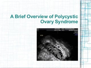 A Brief Overview of Polycystic
Ovary Syndrome
 