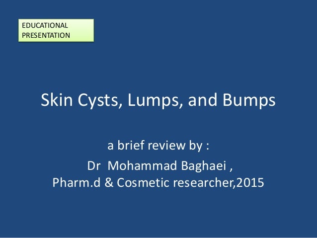 A Brief Review Skin Cysts Lumps And Bumps