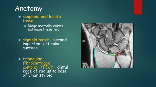 Distal radius fracture management in elderly patients a literature review