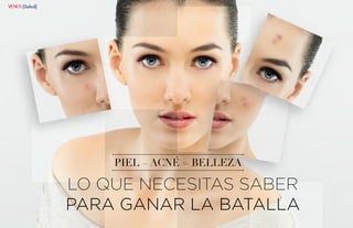 {72}www.revistavenuscuba.wordpress.com
revistavenus@gmail.com {73}www.revistavenuscuba.wordpress.com
revistavenus@gmail.com
LO QUE NECESITAS SABER
PARA GANAR LA BATALLA
PIEL – ACNÉ = BELLEZA
{Salud}
 