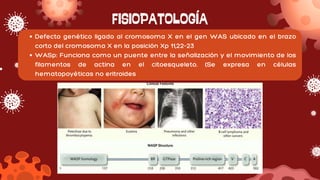 FISIOPATOLOGÍA
Defecto genético ligado al cromosoma X en el gen WAS ubicado en el brazo
corto del cromosoma X en la posición Xp 11,22-23
WASp: Funciona como un puente entre la señalización y el movimiento de los
filamentos de actina en el citoesqueleto. (Se expresa en células
hematopoyéticas no eritroides
 