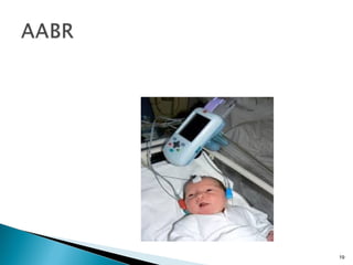 Abr presentation | PPT