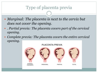 Type of placenta previa
 Marginal: The placenta is next to the cervix but
does not cover the opening.
 . Partial previa: The placenta covers part of the cervical
opening.
 Complete previa: The placenta covers the entire cervical
opening.
 