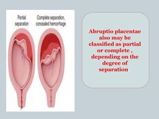 Abruptio placentae
also may be
classiﬁed as partial
or complete ,
depending on the
degree of
separation.
 