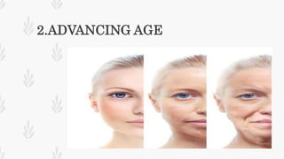 2.ADVANCING AGE
 