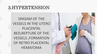 3.HYPERTENSION
SPASAM OF THE
VESSELS IN THE UTERO
PLACENTAL
BED,REPTURE OF THE
VESSELS ,FORMATION
OF RETRO PLACENTAL
HEMATOMA
 