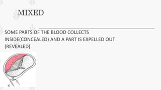 MIXED
SOME PARTS OF THE BLOOD COLLECTS
INSIDE(CONCEALED) AND A PART IS EXPELLED OUT
(REVEALED).
 