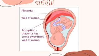 Overview
Give a brief overview of what you’ll cover in your presentation.
 