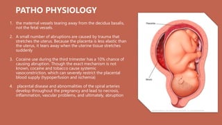 PATHO PHYSIOLOGY
1. the maternal vessels tearing away from the decidua basalis,
not the fetal vessels.
2. A small number of abruptions are caused by trauma that
stretches the uterus. Because the placenta is less elastic than
the uterus, it tears away when the uterine tissue stretches
suddenly
3. Cocaine use during the third trimester has a 10% chance of
causing abruption. Though the exact mechanism is not
known, cocaine and tobacco cause systemic
vasoconstriction, which can severely restrict the placental
blood supply (hypoperfusion and ischemia)
4. placental disease and abnormalities of the spiral arteries
develop throughout the pregnancy and lead to necrosis,
inflammation, vascular problems, and ultimately, abruption
 