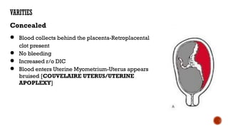 Comprehensive Overview of Abruptio Placentae: Causes, Types, and ...