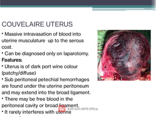 COUVELAIRE UTERUS
•
•
•
•
•
•
Massive intravasation of blood into
uterine musculature up to the serous
coat.
Can be diagnosed only on laparotomy.
Features:
Uterus is of dark port wine colour
(patchy/diﬀuse)
Sub peritoneal petechial hemorrhages
are found under the uterine peritoneum
and may extend into the broad ligament.
There may be free blood in the
peritoneal cavity or broad ligament.
It rarely interferes with uterine
 