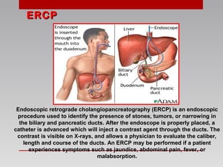 Endoscopic retrograde cholangiopancreatography (ERCP) is an endoscopic
procedure used to identify the presence of stones, tumors, or narrowing in
the biliary and pancreatic ducts. After the endoscope is properly placed, a
catheter is advanced which will inject a contrast agent through the ducts. The
contrast is visible on X-rays, and allows a physician to evaluate the caliber,
length and course of the ducts. An ERCP may be performed if a patient
experiences symptoms such as jaundice, abdominal pain, fever, or
malabsorption.
ERCPERCP
 