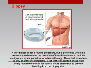 Biopsy
A liver biopsy is not a routine procedure, but is performed when it is
necessary to determine the presence of liver disease and to look for
malignancy, cysts, parasites, or other pathology. The actual procedure
is only slightly uncomfortable. Most of the discomfort arises from
being required to lie still for several hours afterwards to prevent
bleeding from the biopsy site.
 