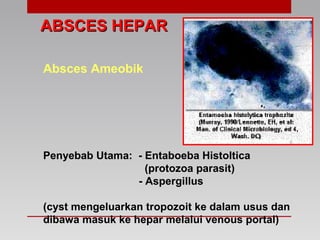 ABSCES HEPARABSCES HEPAR
Absces Ameobik
Penyebab Utama: - Entaboeba Histoltica
(protozoa parasit)
- Aspergillus
(cyst mengeluarkan tropozoit ke dalam usus dan
dibawa masuk ke hepar melalui venous portal)
 