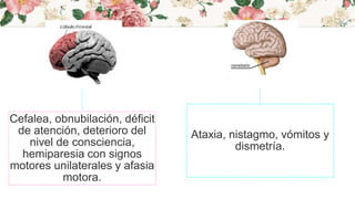T
Cefalea, obnubilación, déficit
de atención, deterioro del
nivel de consciencia,
hemiparesia con signos
motores unilaterales y afasia
motora.
Ataxia, nistagmo, vómitos y
dismetría.
 