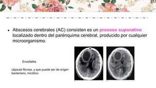 ● Abscesos cerebrales (AC) consisten es un proceso supurativo
localizado dentro del parénquima cerebral, producido por cualquier
microorganismo.
cápsula fibrosa, y que puede ser de origen
bacteriano, micótico
Encefalitis
 