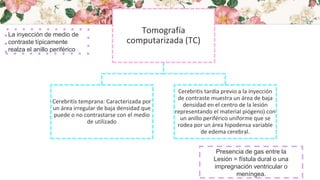 Tomografía
computarizada (TC)
Cerebritis temprana: Caracterizada por
un área irregular de baja densidad que
puede o no contrastarse con el medio
de utilizado
Cerebritis tardía previo a la inyección
de contraste muestra un área de baja
densidad en el centro de la lesión
representando el material piógeno) con
un anillo periférico uniforme que se
rodea por un área hipodensa variable
de edema cerebral.
La inyección de medio de
contraste típicamente
realza el anillo periférico
Presencia de gas entre la
Lesión = fístula dural o una
impregnación ventricular o
meníngea.
 
