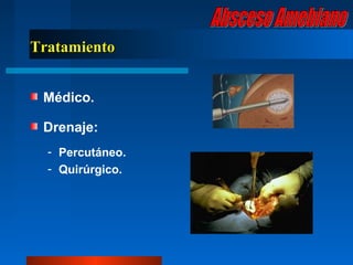 Tratamiento


 Médico.

 Drenaje:
  - Percutáneo.
  - Quirúrgico.
 