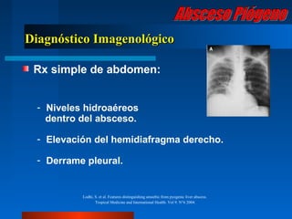 Diagnóstico Imagenológico

 Rx simple de abdomen:


  - Niveles hidroaéreos
    dentro del absceso.

  - Elevación del hemidiafragma derecho.

  - Derrame pleural.


           Lodhi, S. et al. Features distinguishing amoebic from pyogenic liver abscess.
                  Tropical Medicine and International Health. Vol 9. N°6 2004.
 