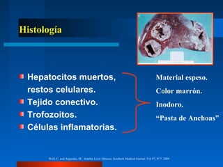 Histología



 Hepatocitos muertos,                                                                 Material espeso.
 restos celulares.                                                                    Color marrón.
 Tejido conectivo.                                                                    Inodoro.
 Trofozoitos.                                                                         “Pasta de Anchoas”
 Células inflamatorias.


      Well, C. and Arguedas, M. Amebic Liver Abscess. Southern Medical Journal. Vol 97, N°7. 2004
 