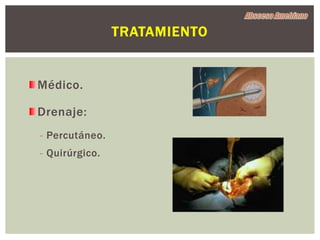 TRATAMIENTO


Médico.

Drenaje:
- Percutáneo.
- Quirúrgico.
 
