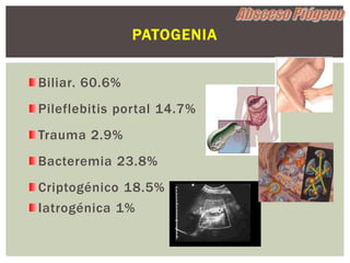 PATOGENIA


Biliar. 60.6%
Pileflebitis portal 14.7%
Trauma 2.9%
Bacteremia 23.8%
Criptogénico 18.5%
Iatrogénica 1%
 