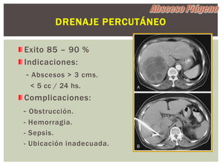DRENAJE PERCUTÁNEO

Exito 85 – 90 %
Indicaciones:
 - Abscesos > 3 cms.
 < 5 cc / 24 hs.
Complicaciones:
- Obstrucción.
- Hemorragia.
- Sepsis.
- Ubicación inadecuada.
 