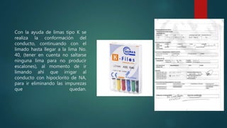 Con la ayuda de limas tipo K se
realiza la conformación del
conducto, continuando con el
limado hasta llegar a la lima No.
40, (tener en cuenta no saltarse
ninguna lima para no producir
escalones), al momento de ir
limando ahí que irrigar al
conducto con hipoclorito de NA,
para ir eliminando las impurezas
que quedan.
 