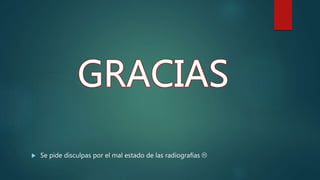  Se pide disculpas por el mal estado de las radiografías 
 