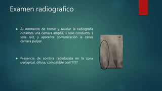 Examen radiografico
 Al momento de tomar y revelar la radiografía
notamos una cámara amplia, 1 solo conducto, 1
sola raíz, y aparente comunicación la caries
cámara pulpar.
 Presencia de sombra radiolúcida en la zona
periapical, difusa, compatible con?????
 