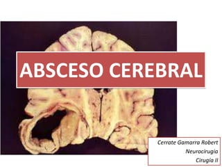 ABSCESO CEREBRAL


            Cerrate Gamarra Robert
                      Neurocirugia
                          Cirugía II
 