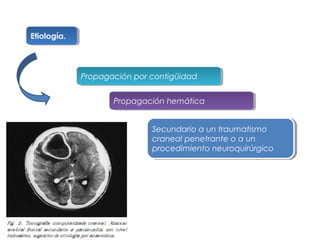 Etiología.
Etiología.

Propagación por contigüidad
Propagación por contigüidad
Propagación hemática
Propagación hemática
Secundario a un traumatismo
Secundario a un traumatismo
craneal penetrante o a un
craneal penetrante o a un
procedimiento neuroquirúrgico
procedimiento neuroquirúrgico

 