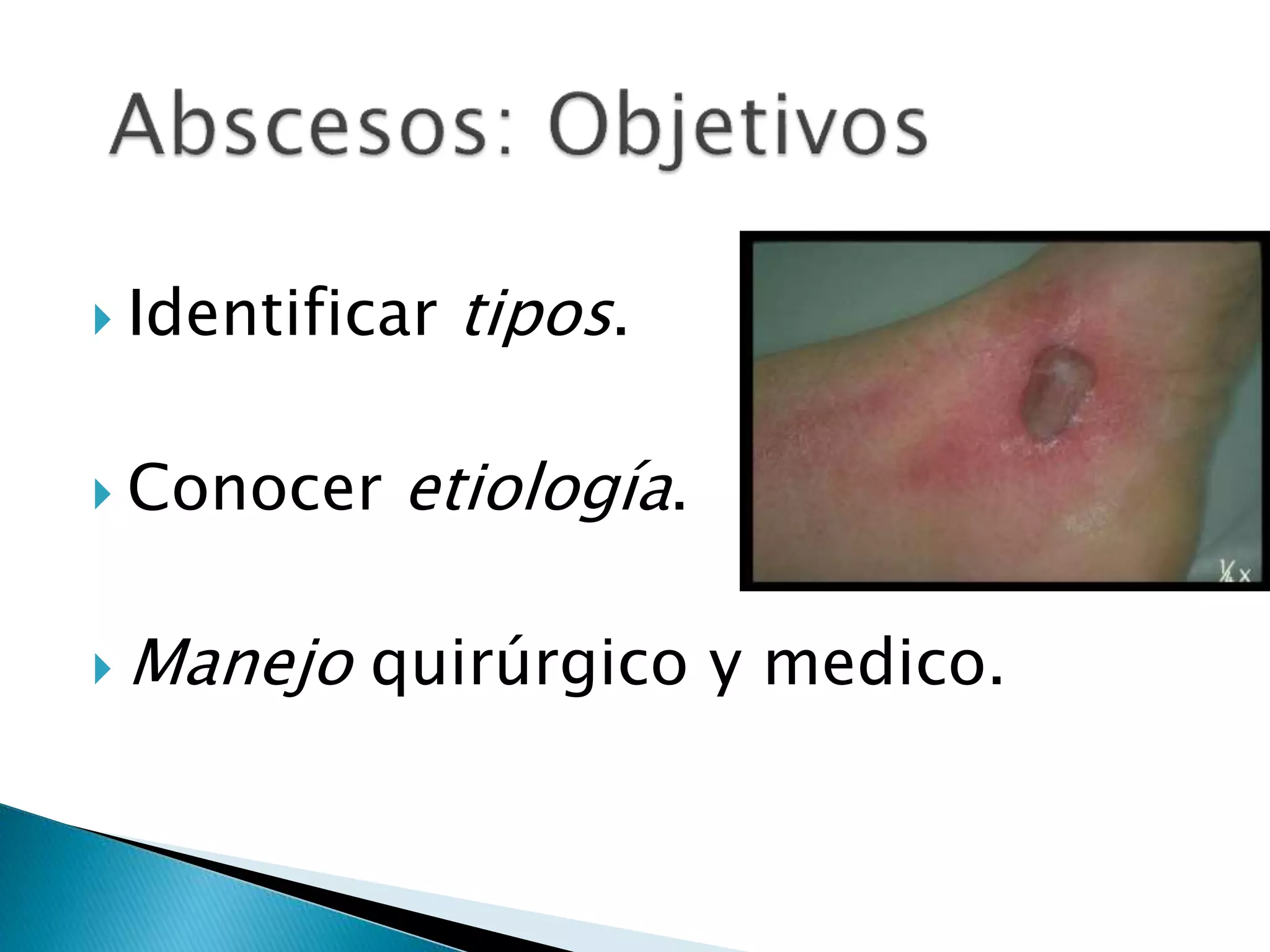 Absceso | PPT