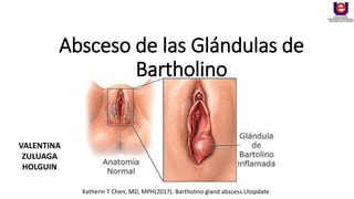 Absceso de las Glándulas de
Bartholino
Katherin T Chen, MD, MPH(2017). Bartholino gland abscess.Utopdate
VALENTINA
ZULUAGA
HOLGUIN
 