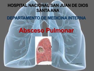 HOSPITAL NACIONAL SAN JUAN DE DIOS
SANTAANA
DEPARTAMENTO DE MEDICINA INTERNA
Absceso Pulmonar
SANTA ANA 08-01-15
 