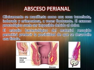 Clínicamente se manifiesta como una zona tumefacta,
indurada y eritematosa, a veces fluctuante. El examen
proctológico suele ser imposible debido al dolor.
El estudio bacteriológico del material recogido
permitirá predecir la posibilidad de que se desarrolle
una fístula.
 