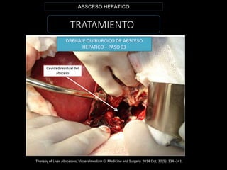 TRATAMIENTO
ABSCESO HEPÁTICO
Therapy of Liver Abscesses, Viszeralmedizin GI Medicine and Surgery. 2014 Oct; 30(5): 334–341.
 