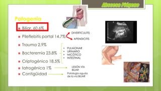 Patogenia
Biliar. 60.6%
Pileflebitis portal 14.7%
Trauma 2.9%
Bacteremia 23.8%
Criptogénico 18.5%
Iatrogénica 1%
Contigüidad
DIVERTICULITIS
APENDICITIS
• PULMONAR
• URINARIO
• MICÓTICO
• INTESTINAL
LESIÓN VÍA
BILIAR
Patología aguda
de la vía BILIAR
 