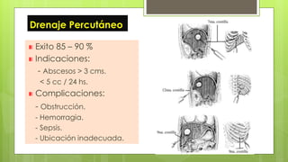 Drenaje Percutáneo
Exito 85 – 90 %
Indicaciones:
- Abscesos > 3 cms.
< 5 cc / 24 hs.
Complicaciones:
- Obstrucción.
- Hemorragia.
- Sepsis.
- Ubicación inadecuada.
 