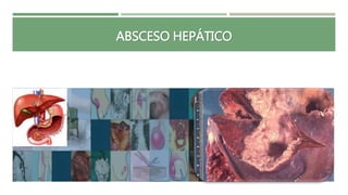 ABSCESO HEPÁTICO
 