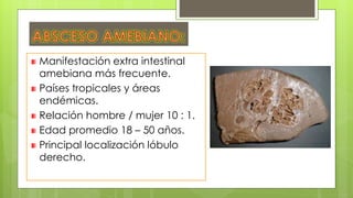 Manifestación extra intestinal
amebiana más frecuente.
Países tropicales y áreas
endémicas.
Relación hombre / mujer 10 : 1.
Edad promedio 18 – 50 años.
Principal localización lóbulo
derecho.
 