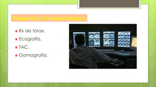 Diagnóstico Inmagenológico
Rx de tórax.
Ecografía.
TAC.
Gamagrafía.
 