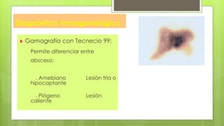 Diagnóstico Inmagenológico
Gamagrafía con Tecnecio 99:
- Permite diferenciar entre
absceso:
. Amebiano Lesión fría o
hipocaptante
. Piógeno Lesión
caliente
 