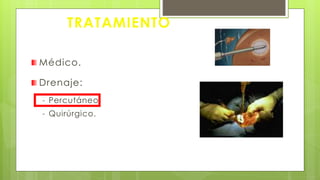 Médico.
Drenaje:
- Percutáneo.
- Quirúrgico.
TRATAMIENTO
 